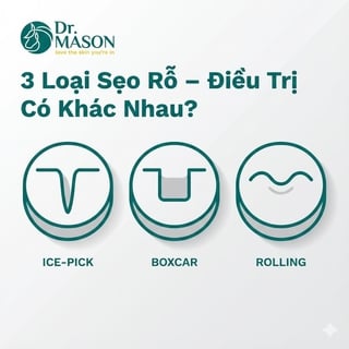 Phân biệt sẹo rỗ đáy nhọn, đáy vuông và đáy tròn