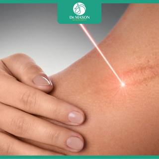 Hiệu quả của laser trong điều trị sẹo lồi