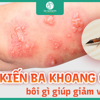 Cách xử lý khi bị kiến ba khoang cắn để tránh nhiễm trùng và sẹo thâm