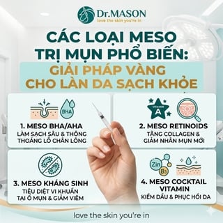 Các loại meso trị mụn phổ biến: giải pháp vàng cho làn da sạch khỏe