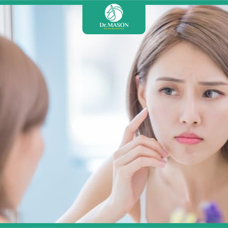 Phác đồ trị mụn an toàn và hiệu quả