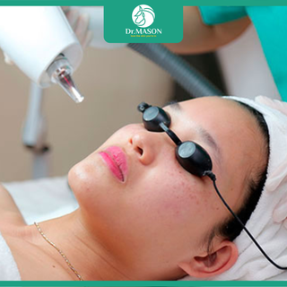 Phác đồ điều trị nám chuẩn Bộ Y tế