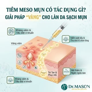 Tiêm Meso Mụn Có Tác Dụng Gì? Giải Pháp Cho Làn Da Sạch Mụn