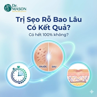 Trị sẹo rỗ bao lâu hiệu quả và có hết hoàn toàn?