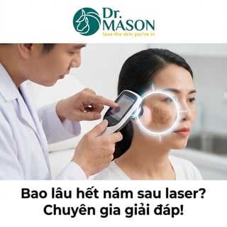 Bắn laser trị nám thì bao lâu hết thâm nám? Bác sĩ giải đáp