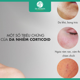 Cách nhận biết da nhiễm corticoid và thời điểm cần gặp bác sĩ da liễu