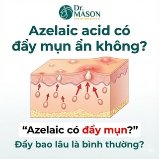 Dấu hiệu và thời gian đẩy mụn của Azelaic acid