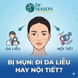 Bị mụn nên khám da liễu hay nội tiết?