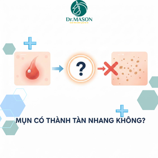 Mụn có thành tàn nhang không? Giải thích đúng theo góc nhìn da liễu