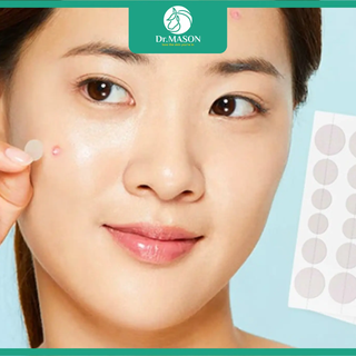 Ứng dụng công nghệ vi kim trong miếng dán mụn