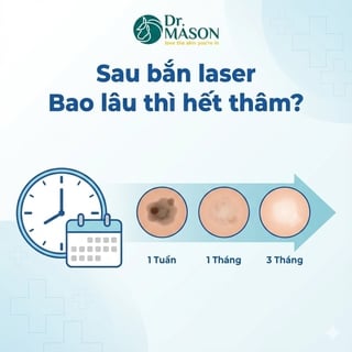Sau khi bắn laser bao lâu thì hết thâm? 1 buổi có đủ không?