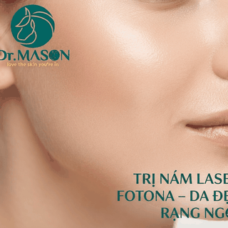 [Bác Sĩ Đáp] Trị Nám Bằng Laser Fotona Khoảng Mấy Buổi Sẽ Hết?