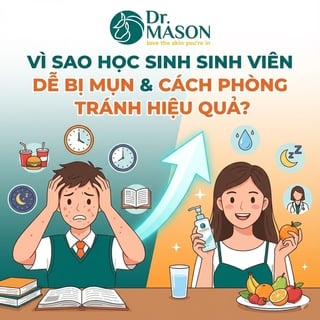 Vì sao học sinh, sinh viên dễ bị mụn và cách phòng ngừa
