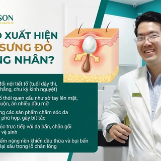Cách làm xẹp mụn không nhân