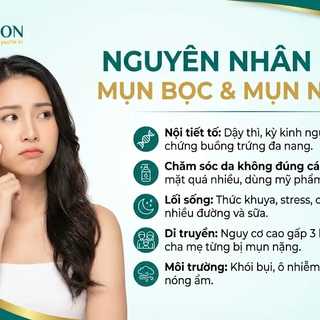 Phân loại và hướng điều trị từng dạng mụn theo chuẩn y khoa hiện đại
