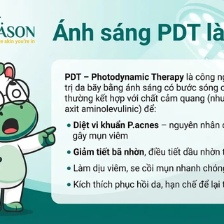 PDT trị mụn là gì? Nguyên lý và hiệu quả thực tế