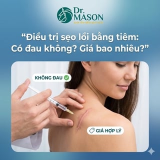 Tiêm sẹo lồi có đau không và giá bao nhiêu?