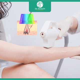 Tần suất triệt lông lý tưởng cho từng vùng