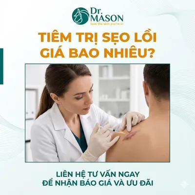 Tiêm trị sẹo lồi giá bao nhiêu? Bảng giá