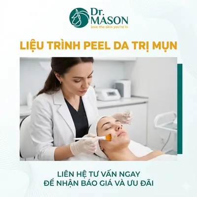 Liệu trình peel da trị mụn- 6 buổi