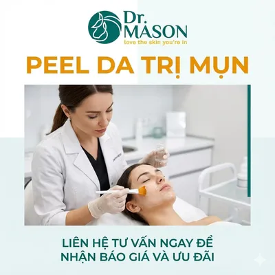 Peel da trị mụn