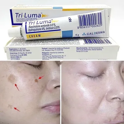 Kem Trị Nám Tri-Luma Galderma