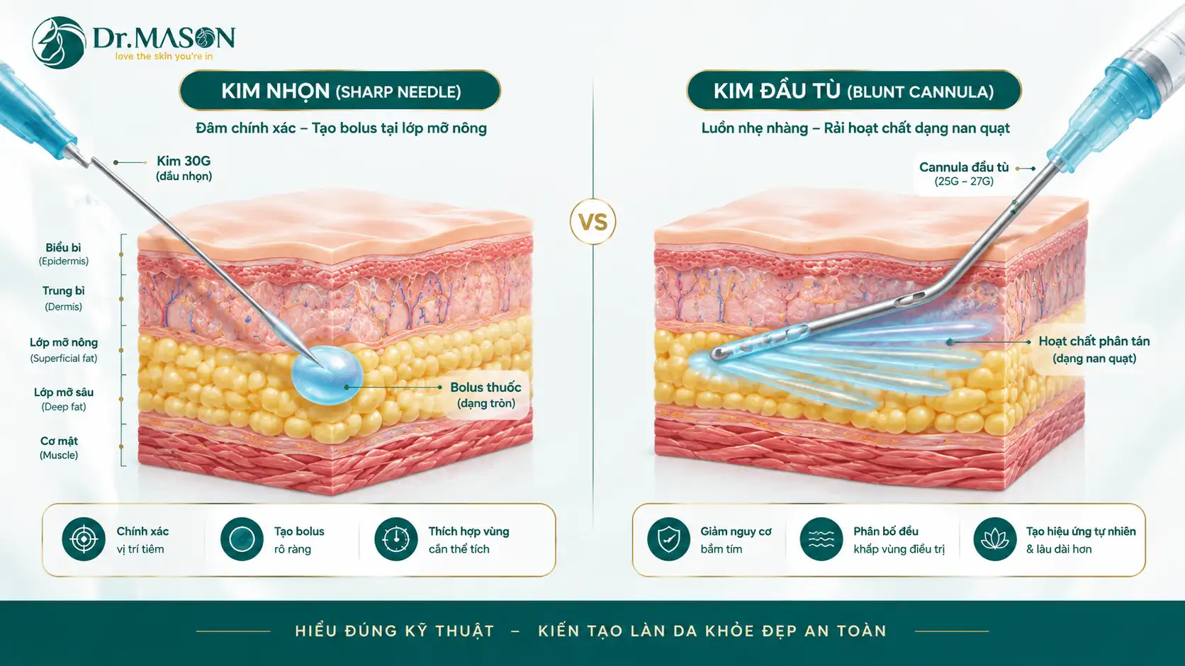 So sánh kỹ thuật tiêm điểm và tiêm Cannula
