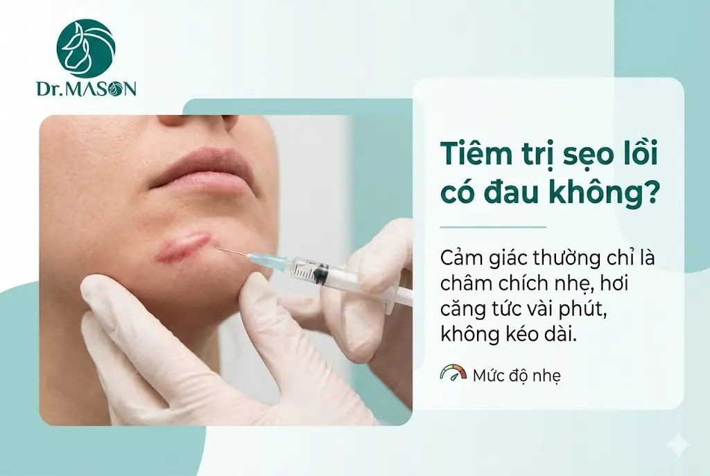 tiêm sẹo lồi có đau không?
