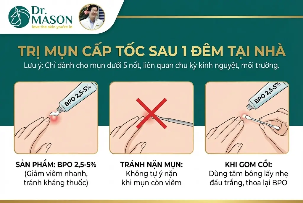 trị mụn cấp tốc sau 1 đêm tại nhà