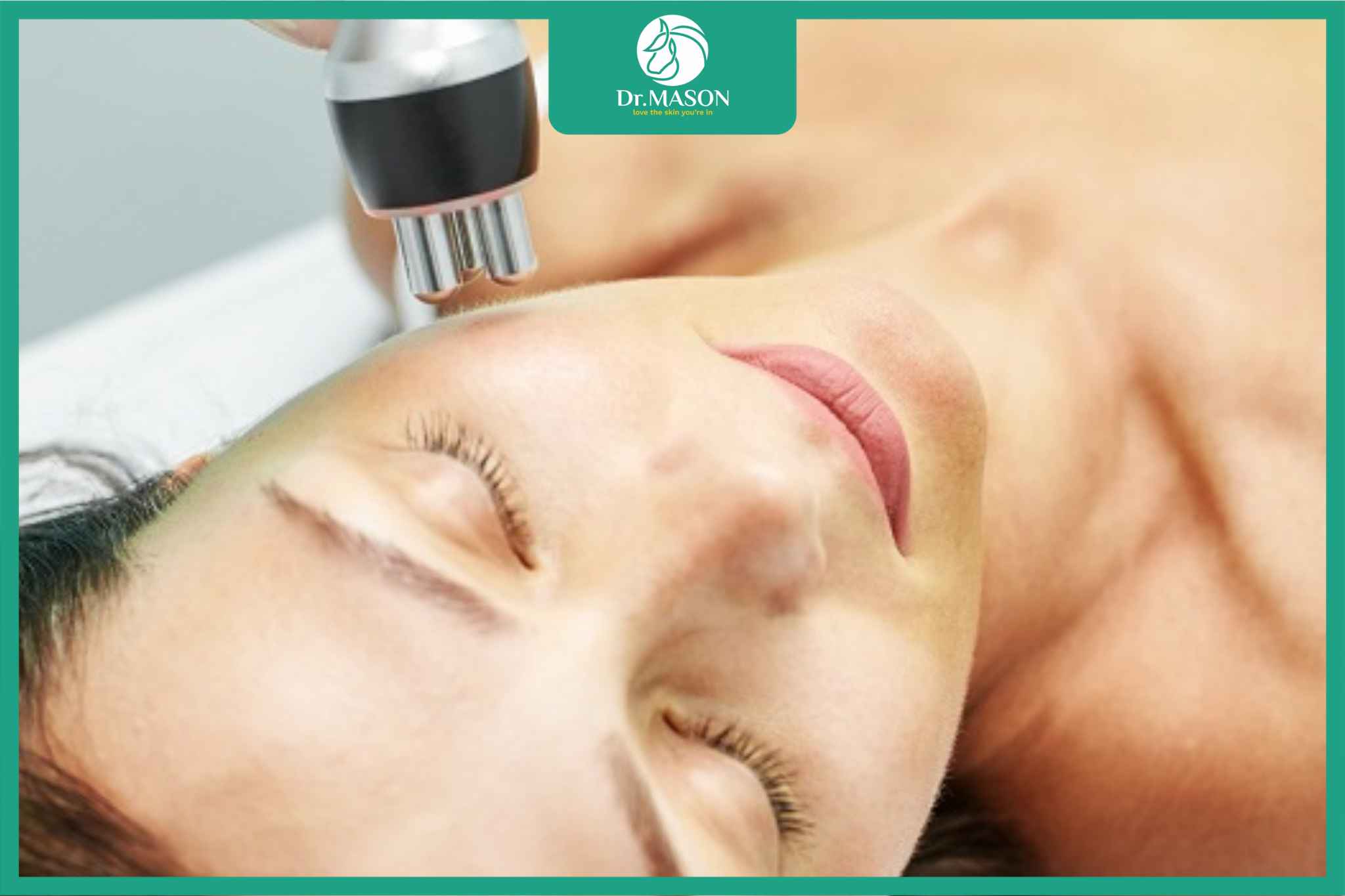 phục hồi điện di sau nám