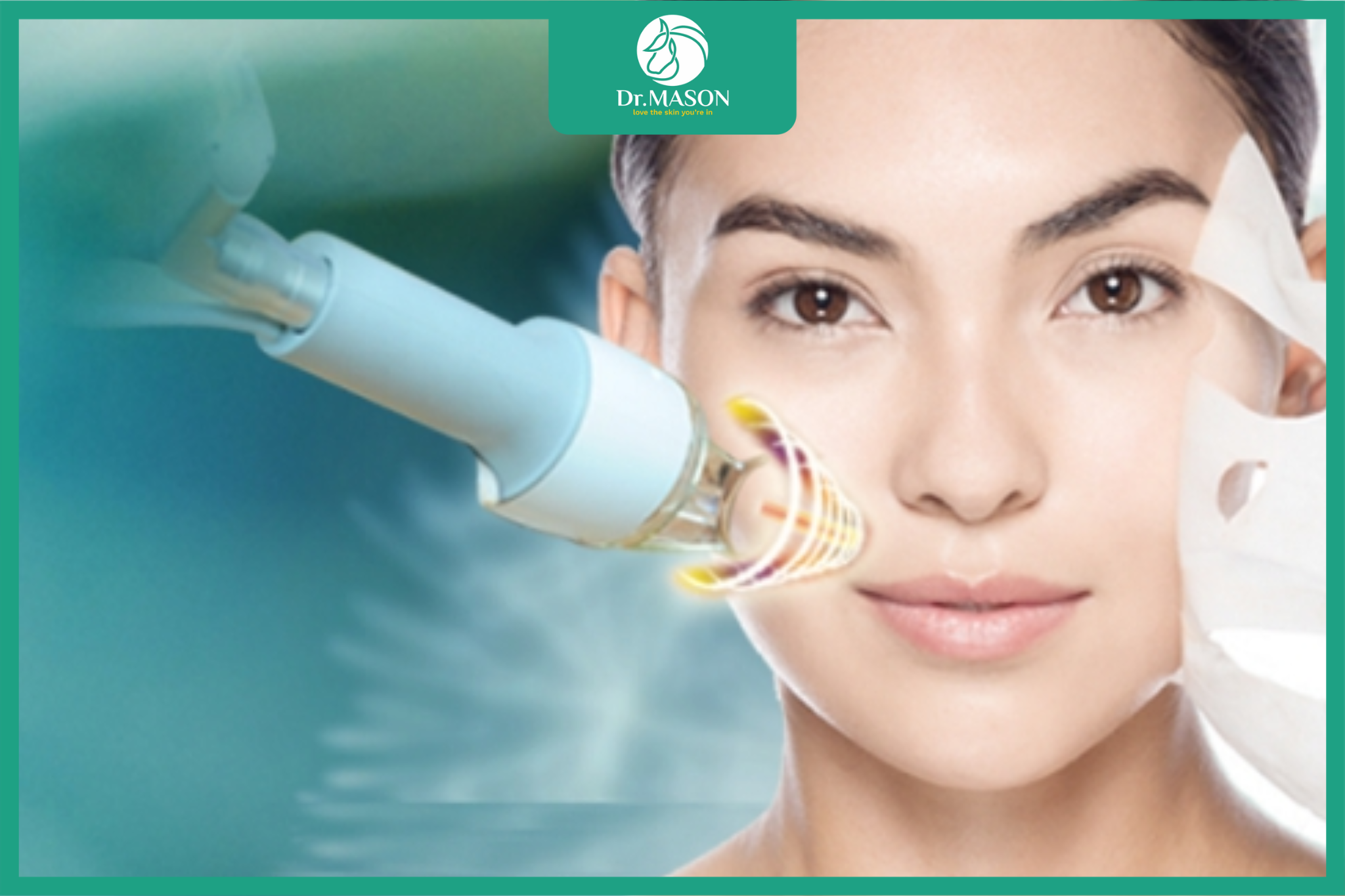 công nghệ laser trị nám