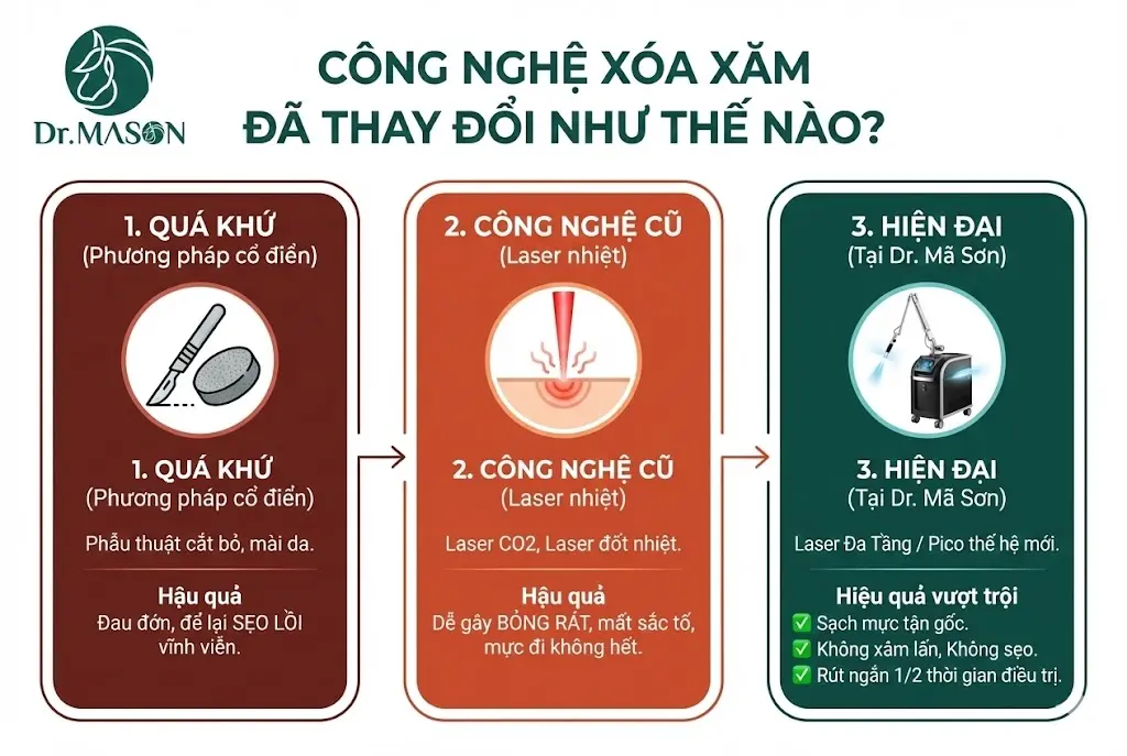 lịch sử công nghệ xóa xăm