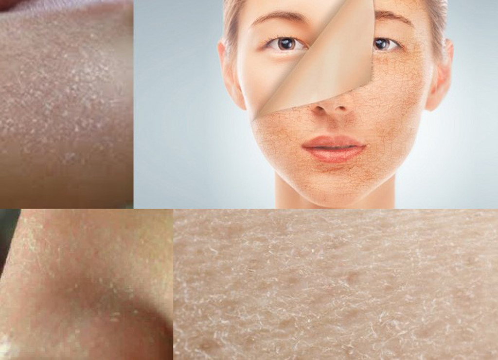 Để cải thiện làn da hiệu quả, bạn cần hiểu những nguyên nhân khiến da xỉn màu. Để cải thiện làn da hiệu quả, bạn cần hiểu những nguyên nhân khiến da xỉn màu.