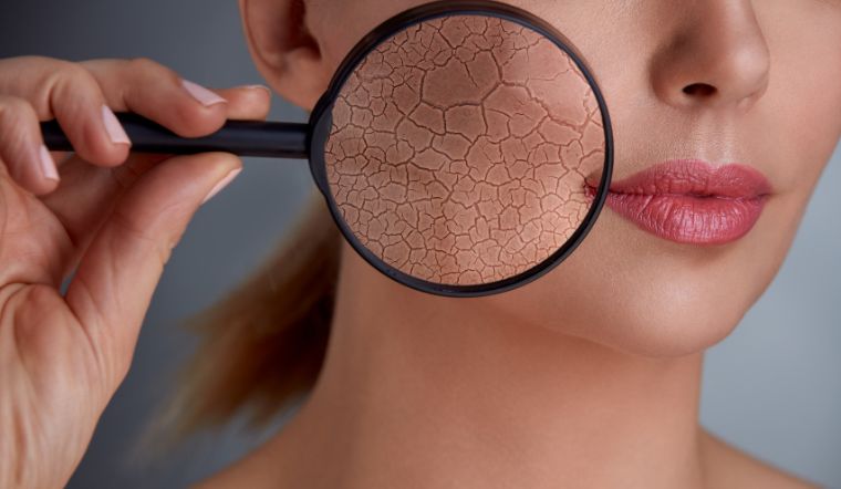 Skin barrier là lớp ngoài cùng của da có nhiệm vụ bảo vệ da khỏi tác nhân bên ngoài và giữ độ ẩm cho làn da. Skin barrier là lớp ngoài cùng của da có nhiệm vụ bảo vệ da khỏi tác nhân bên ngoài và giữ độ ẩm cho làn da.