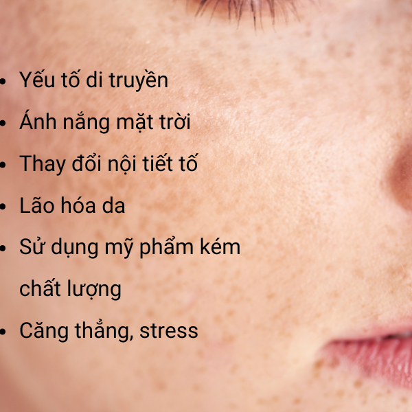 Serum trị nám tàn nhang trắng da căng bóng: Bí quyết cho làn da hoàn hảo