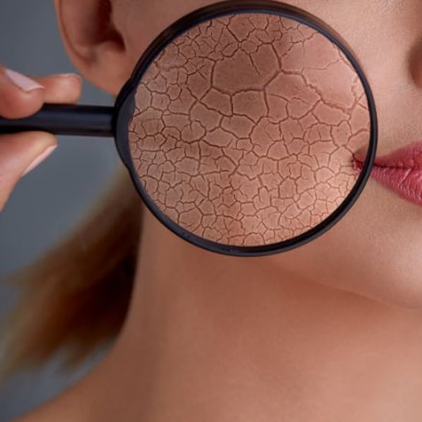 Cách Phục Hồi Hàng Rào Bảo Vệ Da Cho Da Mỏng Yếu Sau Treatment