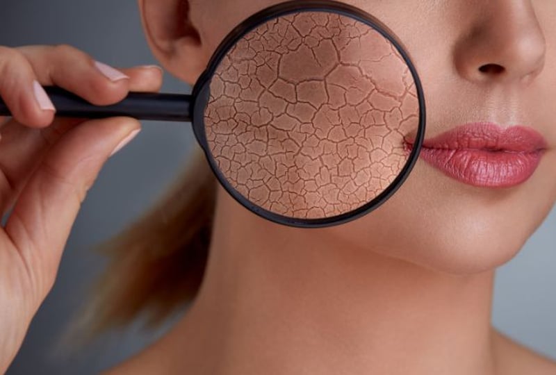 Cách Phục Hồi Hàng Rào Bảo Vệ Da Cho Da Mỏng Yếu Sau Treatment