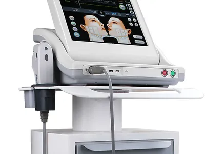 Công nghệ nâng cơ hifu là gì