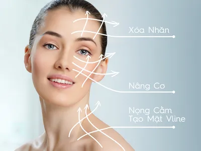 Nâng cơ mặt bằng Hifu giá bao nhiêu