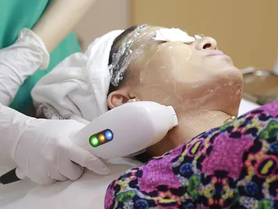 Trẻ hoá da bằng máy công nghệ hifu