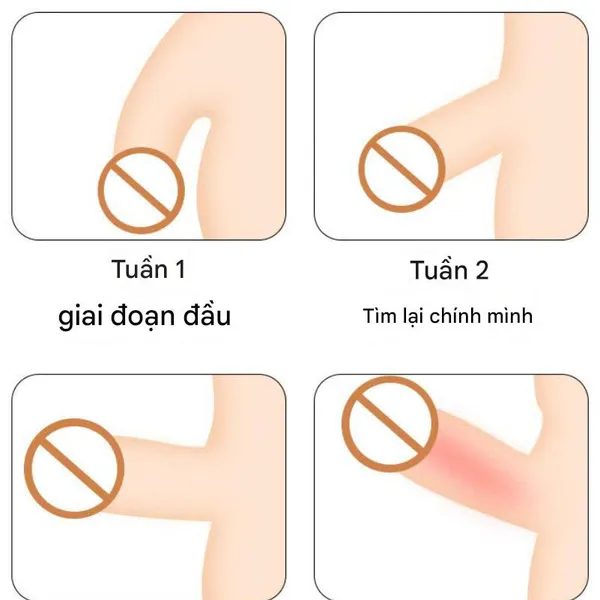 máy masa quy đầu tra tấn bằng điện giật quy đầu, dụng cụ huấn luyện dương vật, dụng cụ thủ dâm nam SM, dụng cụ tra tấn thú vị, tra tấn phần thân dưới, đồ dùng tình dục cho nô lệ 