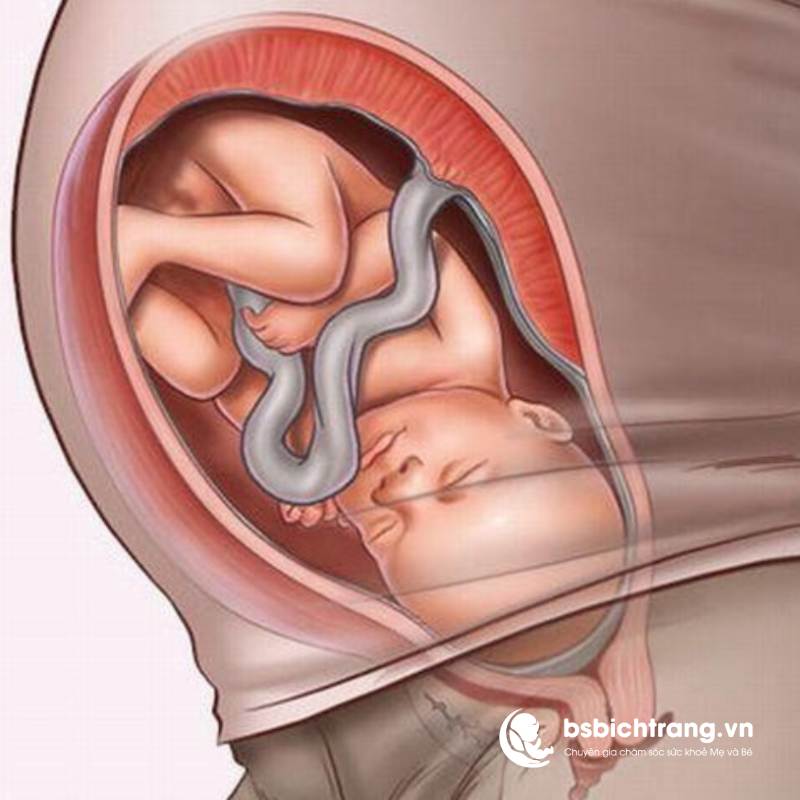 Em bé trở đầu vào thời điểm nào?