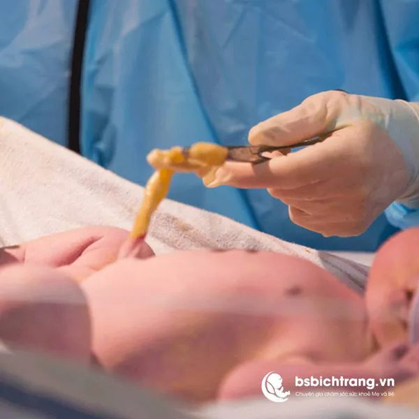Chi phí để lưu trữ tế bào gốc máu cuốn rốn có cao không?