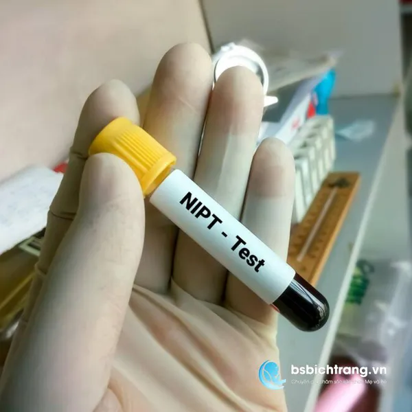 Xét nghiệm NIPT có chính xác không? Chia sẻ từ Bs Bích Trang BMT – Chuyên gia chăm sóc sức khỏe Mẹ và Bé