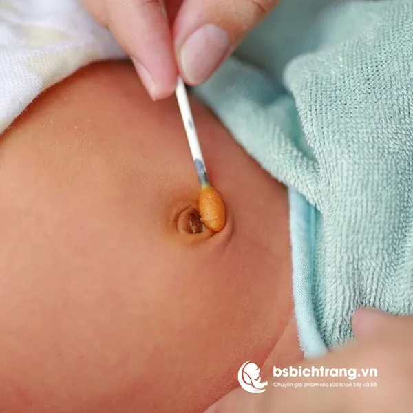 Bao lâu thì bé sẽ rụng rốn? – Chia sẻ từ Bs Bích Trang BMT