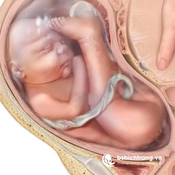 Em bé đẻ ngược có nguy hiểm không? Chia sẻ từ Bác sĩ Bích Trang BMT – Chuyên gia chăm sóc sức khỏe Mẹ và Bé