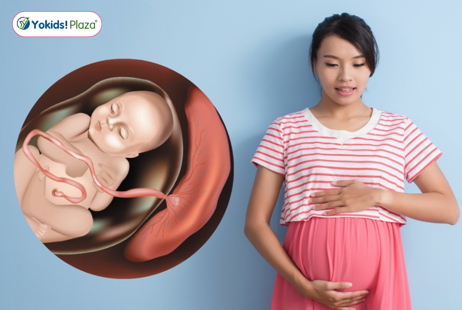 Nhau thai bám mặt trước là gì? Nhau thai bám mặt trước là gì?