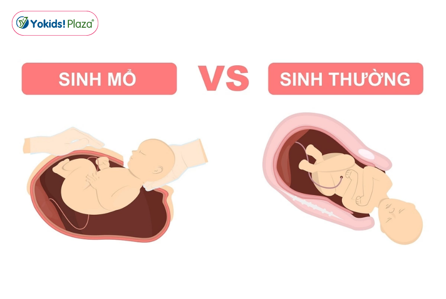 Những yếu tố quyết định mẹ sinh thường hay sinh mổ Những yếu tố quyết định mẹ sinh thường hay sinh mổ