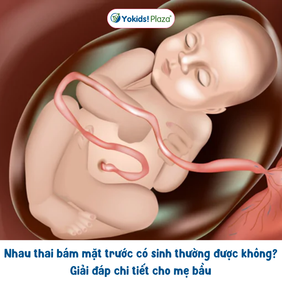 Nhau thai bám mặt trước có sinh thường được không? Giải đáp chi tiết cho mẹ bầu