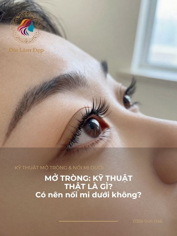 Bóc tách bản chất kỹ thuật tạo hiệu ứng mở tròng và giải đáp có nên nối mi dưới không